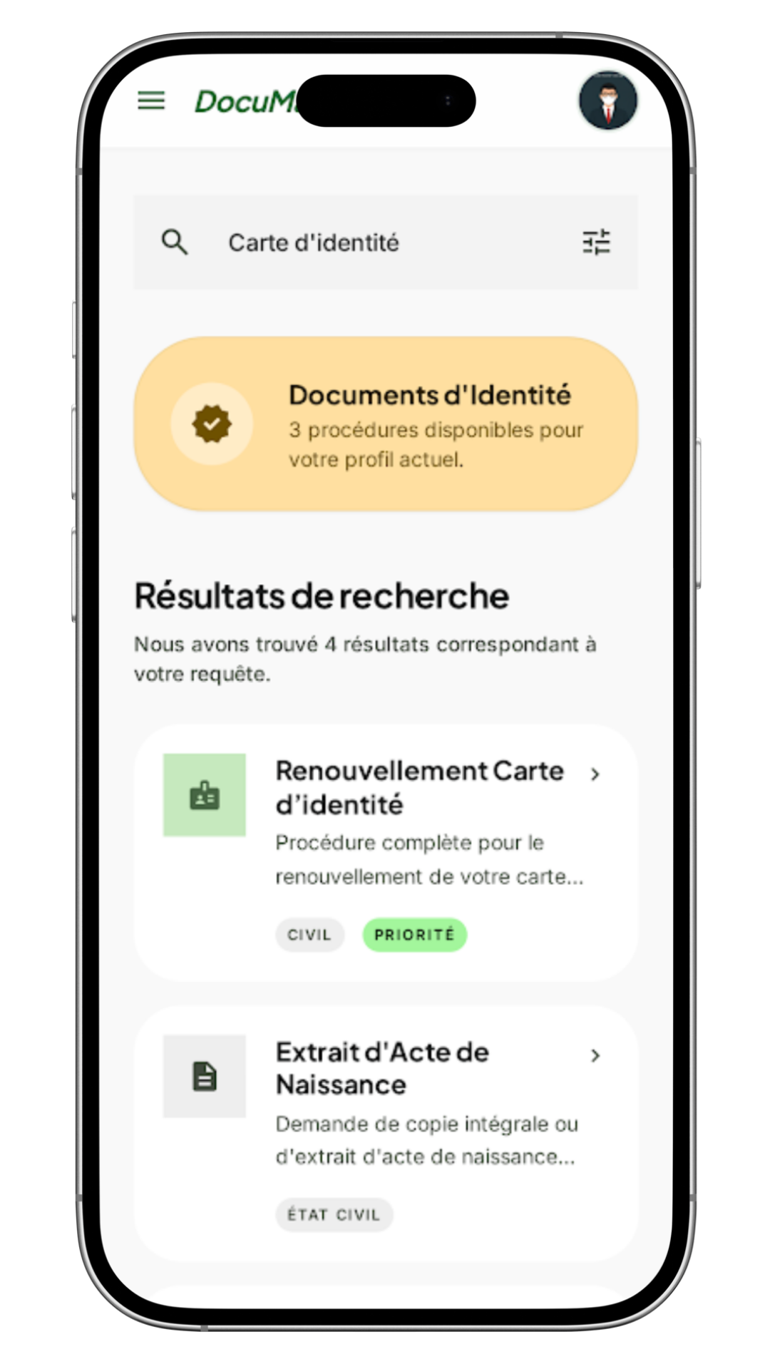 Aperçu de l'étape : Suivre les étapes